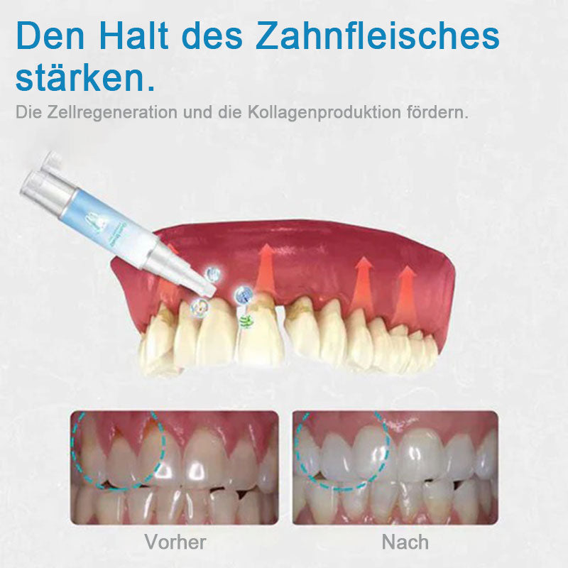 Reparaturgel für die Zähne (Kaufe 1 erhalte 1 kostenlos)