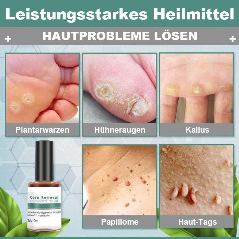 Extra stärkendes Gel zum Entfernen von Hühneraugen