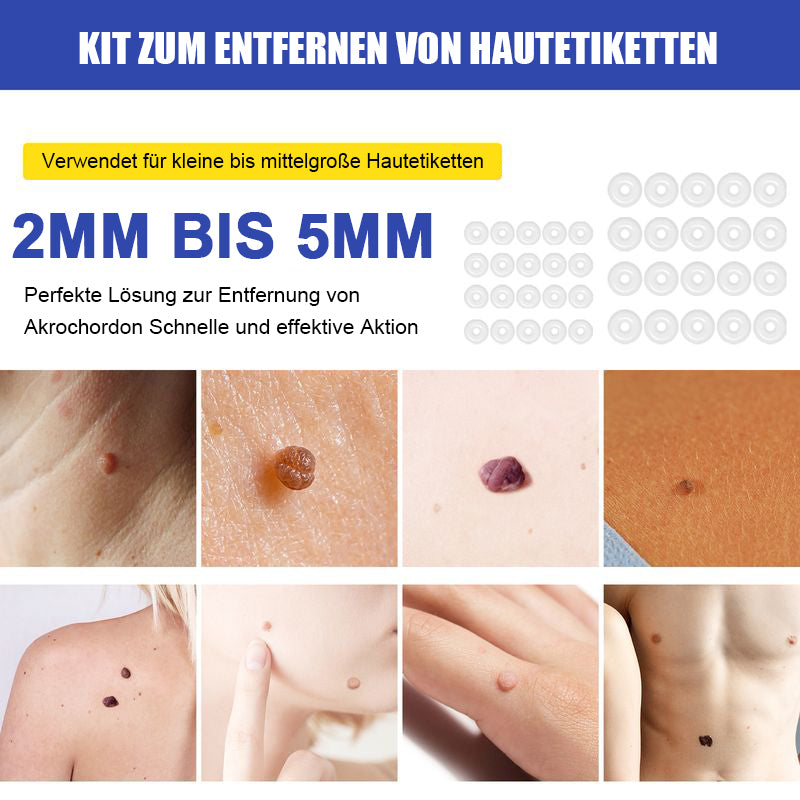 Kit zur Entfernung von Hautmarkierungen