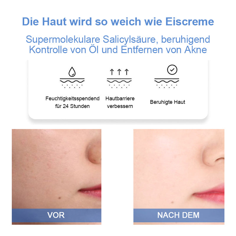 Salicylsäure-Eiscreme-Maske,KAUFEN SIE 1 UND ERHALTEN SIE 1 KOSTENLOS (65 g*2)