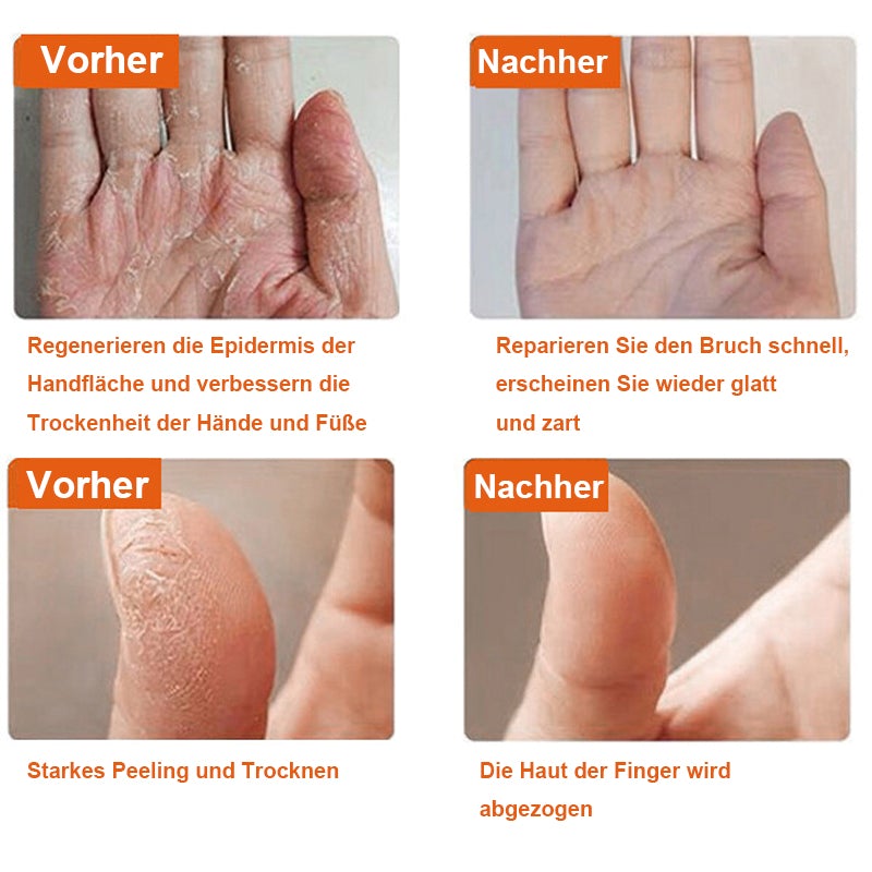 Anti-Cracking-Wintergel