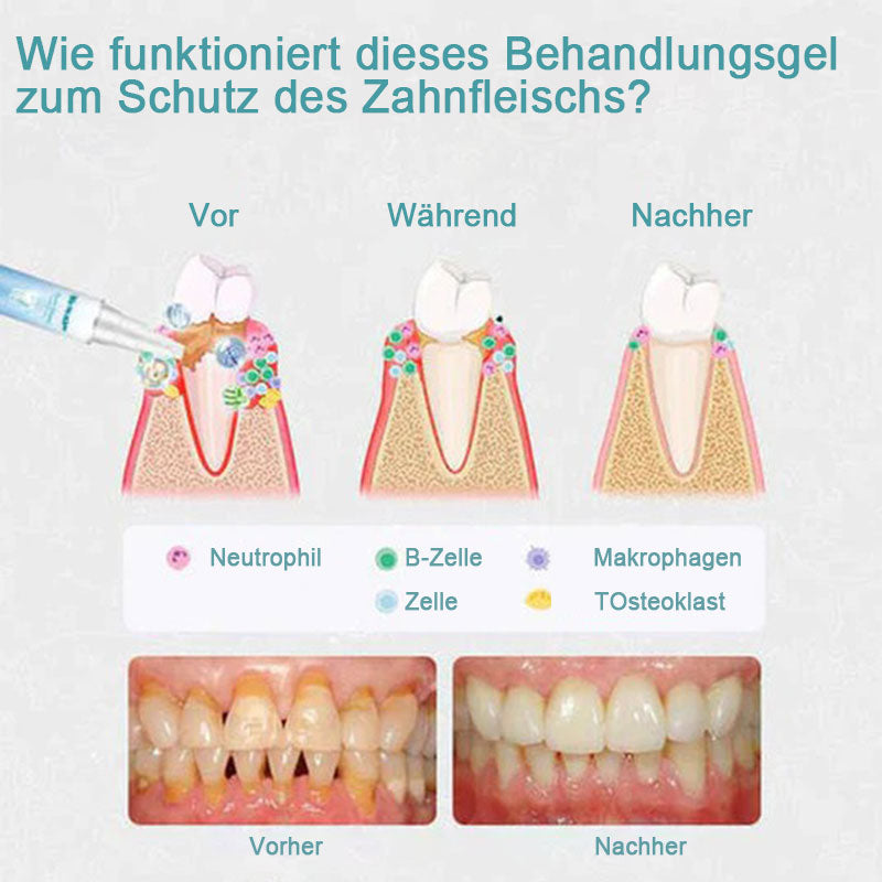 Reparaturgel für die Zähne (Kaufe 1 erhalte 1 kostenlos)